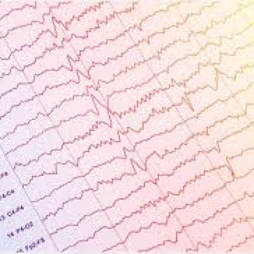 Elettroencefalogramma Aosta.
